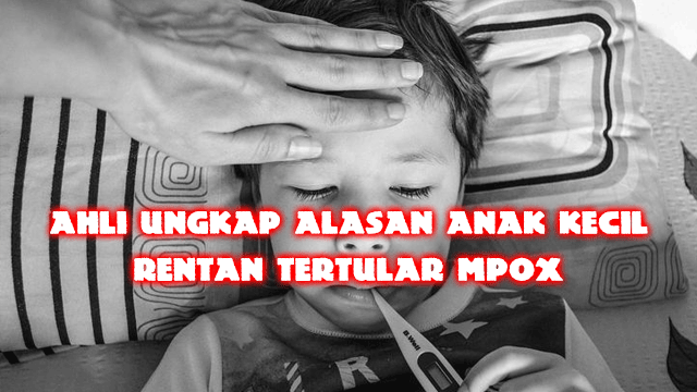 Ahli Ungkap Alasan Anak Kecil Rentan Tertular Mpox